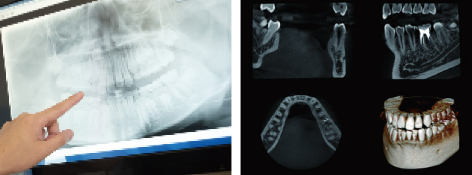 デジタルレントゲン・CT診断装置2